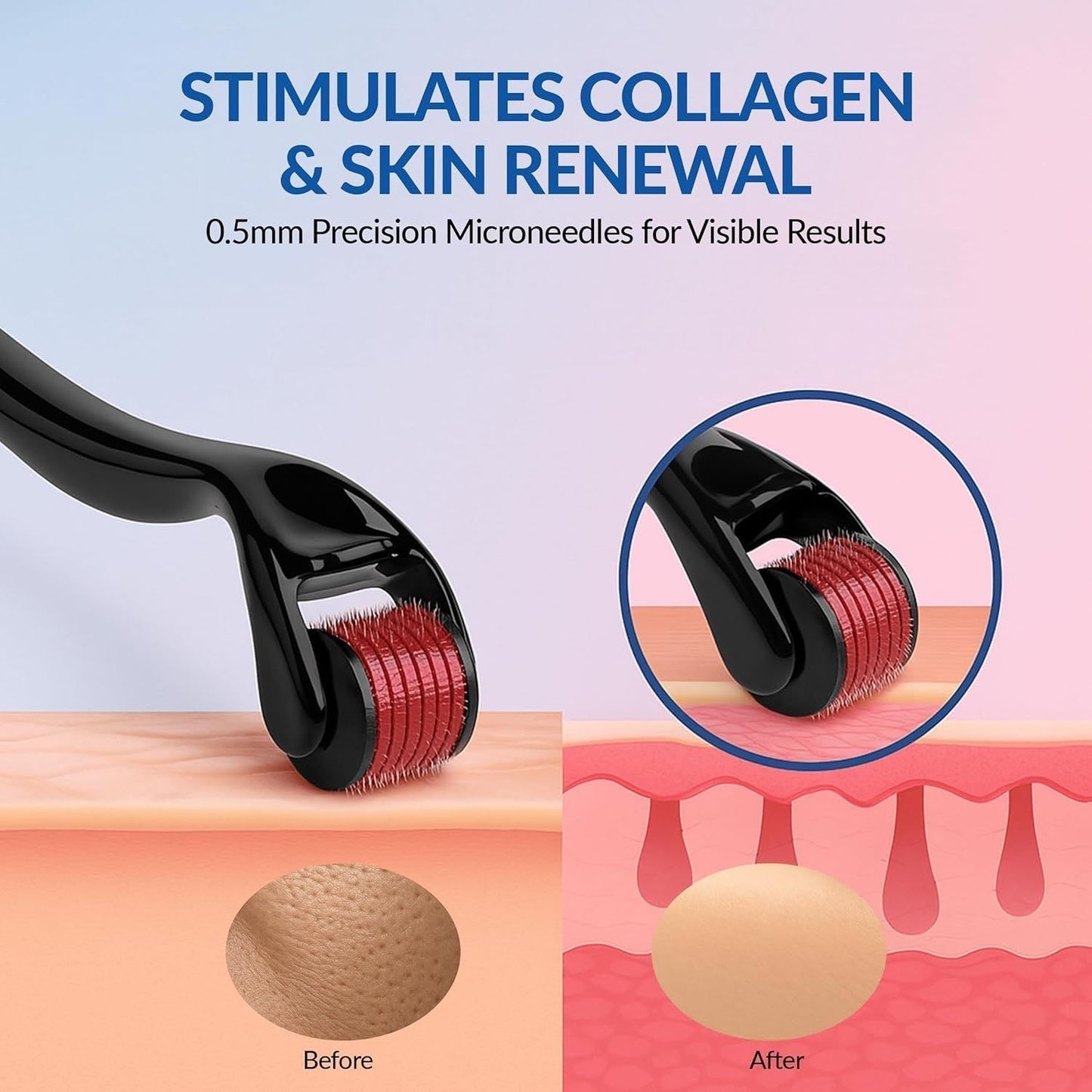 Microneedle Derma Roller for Face (1 Pc, 0.5mm)